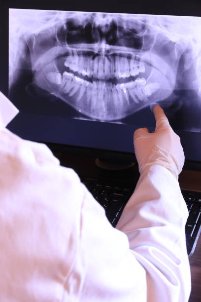 Best Teeth Whitening  in Evanston, WY