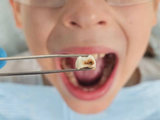 Best Broken Tooth Emergency  in Evanston, WY