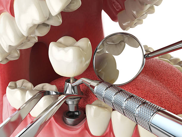 Best Emergency Gum Pain Relief  in Evanston, WY